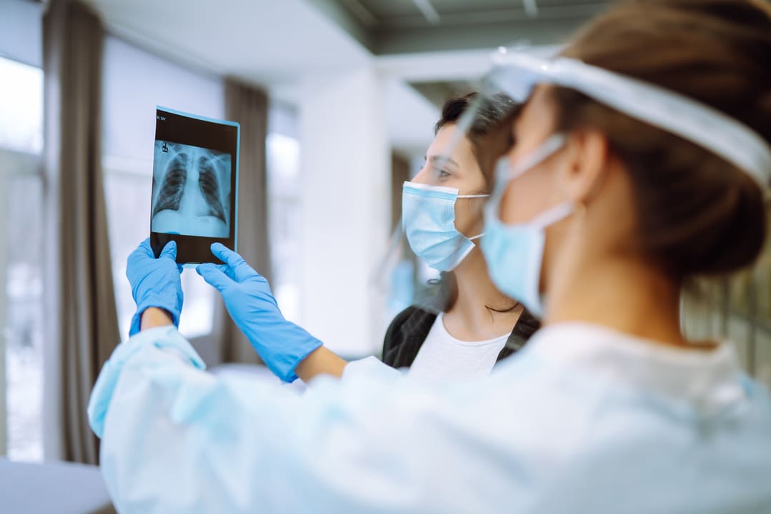 tuberculose